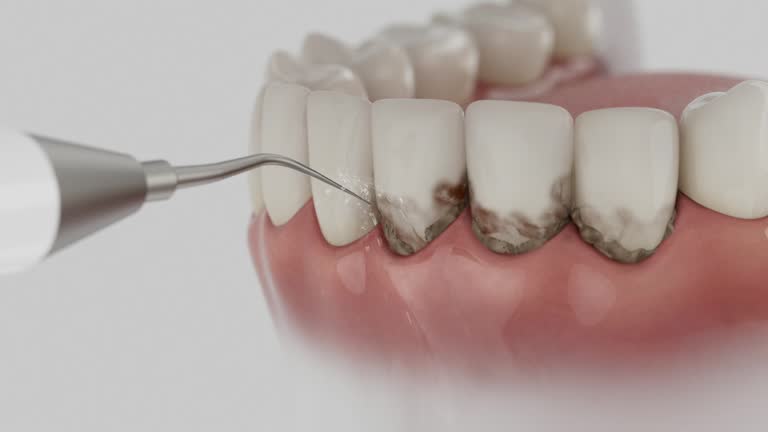 Trusted Root Canal Treatment service in Upper Arlington, OH - Dentist Open Now